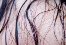 “땀 때문에 두피가 따가워요”…지금 필요한 건 두피 ‘세균 케어’ black hair