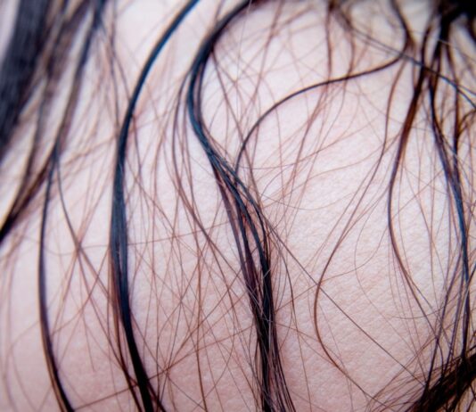 “땀 때문에 두피가 따가워요”…지금 필요한 건 두피 ‘세균 케어’ black hair