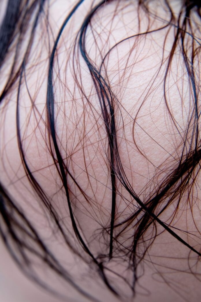 Photo by Mark Craemer black hair