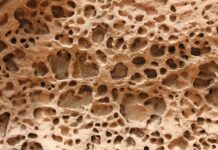 골다공증 예방, 뼈 건강을 지키는 생활습관 5가지 a close up of a rock with holes in it